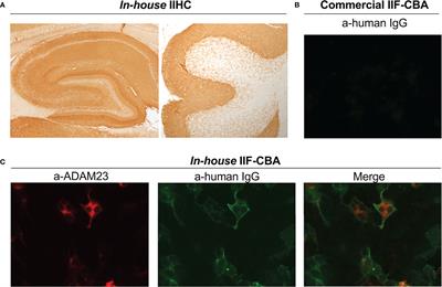 The diagnosis of anti-LGI1 encephalitis varies with the type of immunodetection assay and sample examined